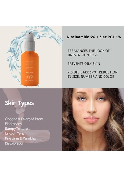 Akne Ve Sivilce Karşıtı Siyah Nokta Önleyici Niacinamide Cilt Bakım Serumu 30 Ml