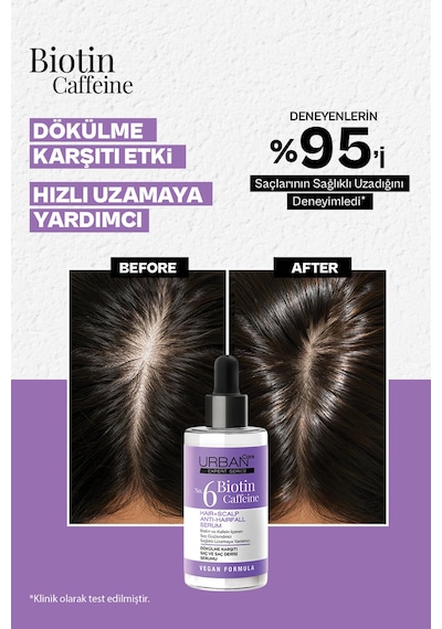 Expert Biotin Ve Kafein Dökülme Karşıtı Şampuan&tonik&serum Set-vegan