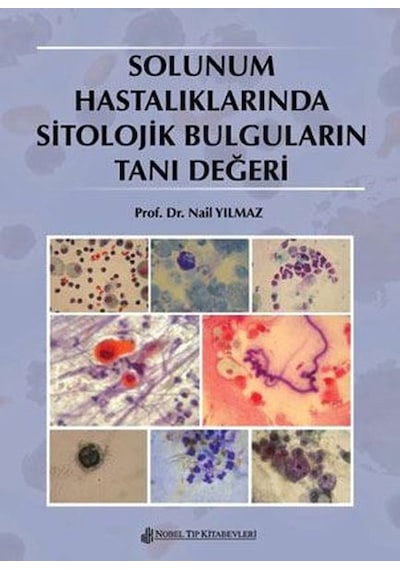 Solunum Hastalıklarında Sitolojik Bulguların Tanı Değeri- Nobel Tıp Kitabevleri