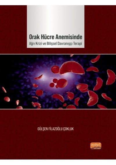 Orak Hücre Anemisinde Ağrı Krizi ve Bilişsel Davranışçı Terapi - Gülşen Filazoğlu Çokluk - Nobel Bilimsel Eserler