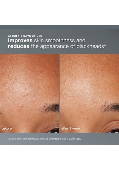 Dermalogica Daily Microfoliant Ölü Derileri Temizleyici 74 Gr