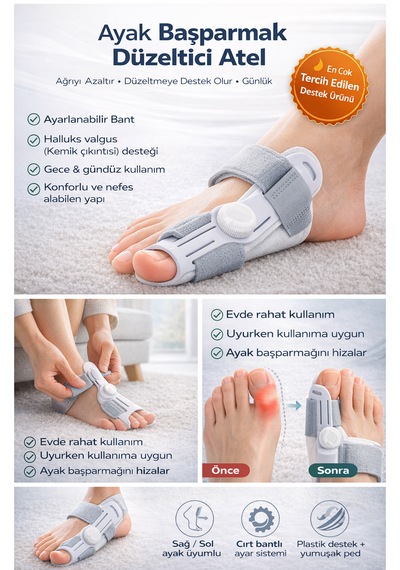 Ayak Başparmak Düzeltici Atel Halluks Valgus Kemik Düzeltme Aparatı Ayarlanabilir Ortopedik Destek