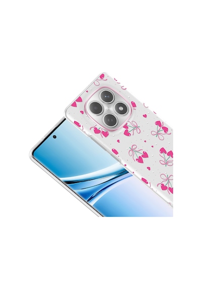 Xiaomi Redmi Note 15 5g Kılıf Çiçek Ve Fiyonk Desenli Kamera Yükseltili Cherena Premium Mavi