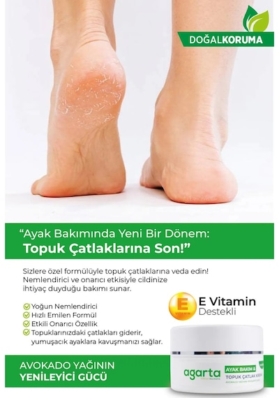 Agarta Ayak Ve Topuk Çatlak Bakım Kremi 100ml