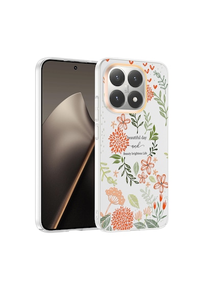 Xiaomi 15t Kılıf Çiçek Ve Fiyonk Desenli Kamera Yükseltili Celikaksesuar Premium Diğer