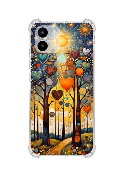 Printify Redmi A2 Plus İle Uyumlu Düşlerin Dansı Serisi Yıldız Yolculuğu Tasarımlı Uv Baskılı Köşe Korumalı Antişok Kılıf Şeffaf