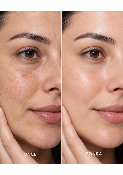 Vitamin C Serum 30 Ml Leke Karşıtı, Aydınlatıcı Ve Cilt Tonu Eşitleyici Bakım