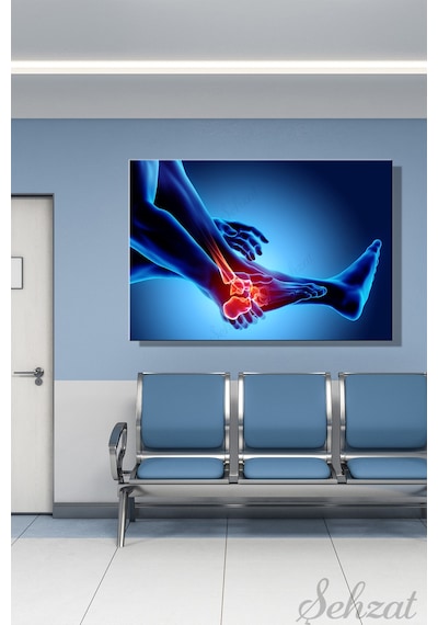 Yatay Tekli Kanvas Duvar Tablosu Modern Klinik Hastane Doktor Röntgen Film Ayak Bilek Ağrı 3d İş