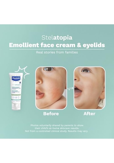Mustela Stelatopia Emollient Yüz Kremi 40ml