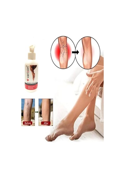 Süper Varison Bacak Bakım Kremi 120 Ml