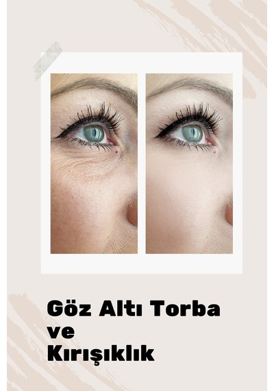Göz Çevresi Canlandırıcı Gözaltı Morluğu, Torbalanma, Şişlik Gözaltı Bakım Serumu 30ml