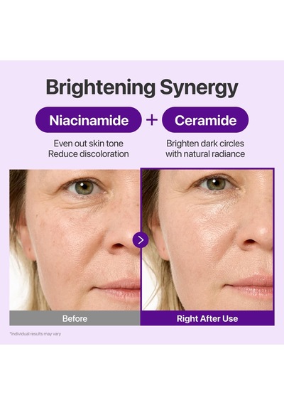Tr No.9 Nad+ Retinal Volumetox Eye Cream, Anti-aging Treatment For Wrinkles, Fine Lines, Dark Circles & Dark Spots, Gent