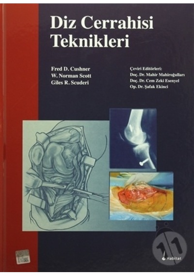 Diz Cerrahisi Teknikleri