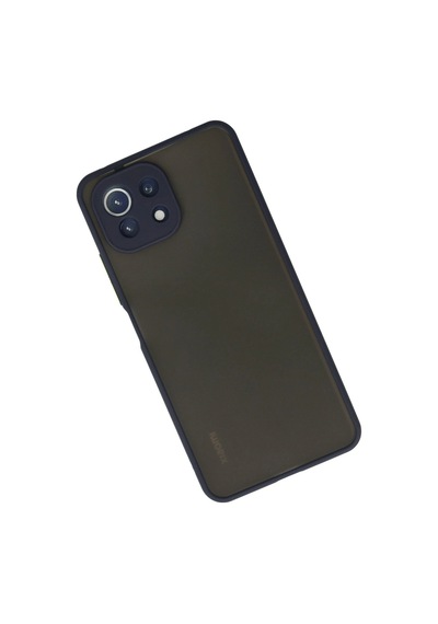 Cosmotex Newface Xiaomi Mi 11 Lite Kılıf Montreal Silikon Kapak - Lacivert