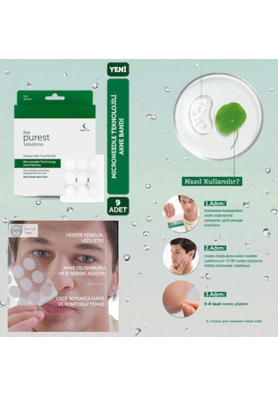 The Purest Solutions Microneedle Teknolojili Akne Bant, Akne Karşıtı Yama, Mikroiğneli Bant, 9'lu