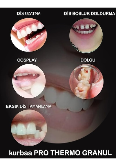 Pro Thermo Diş Granülleri, Eksik Diş Giderme, Diş Onarımı, Diş Dolgusu Onarım Granülleri Kendinden Yapışkanl