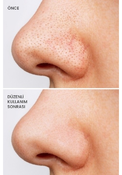 Royues Kolajen Kil Maskesi 125 G