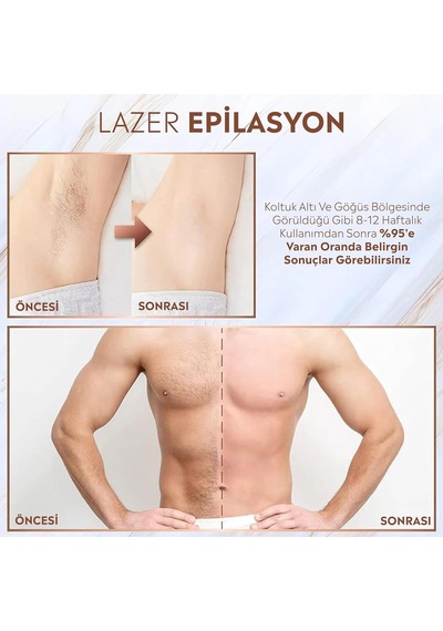 Brl-10 Ipl Tüy Alma Cihazı Lazer Epilasyon