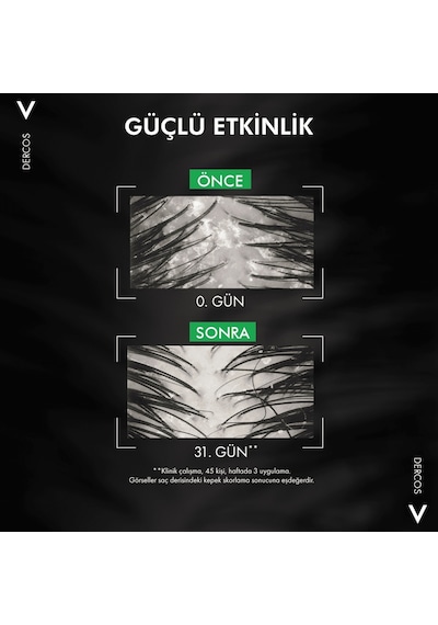 Vichy Dercos Dandruff Normal ve Yağlı Saçlar İçin Kepek Karşıtı Şampuan 390 ML