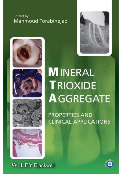 Mineral Trioxide Aggregate: Properties And Clinical Applications