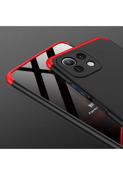 Xiaomi Mi 11 Lite Kilif Zore Kamera Korumali 360 Tam Koruma Ays 496999698