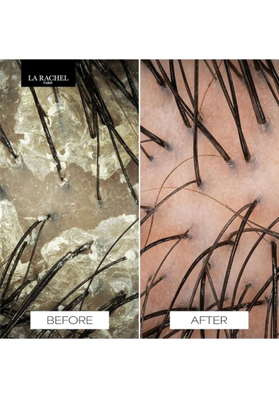 Saç Dökülmesine Karşı Şampuan Apigenin, Oleanolic Acid, Biotinoyl Tripeptide-1, Biotin Ve Bitkisel Özler İle Kökleri Güçlendirir, Uzamayı Destekler