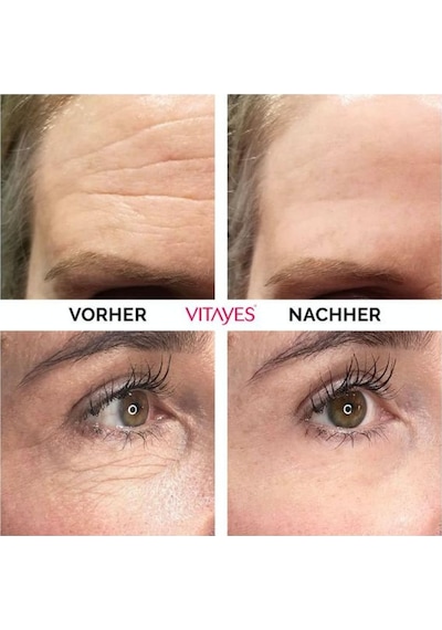 Vitayes Instant Ageback Anında Etkili Yüz Germe Kremi 15 ML