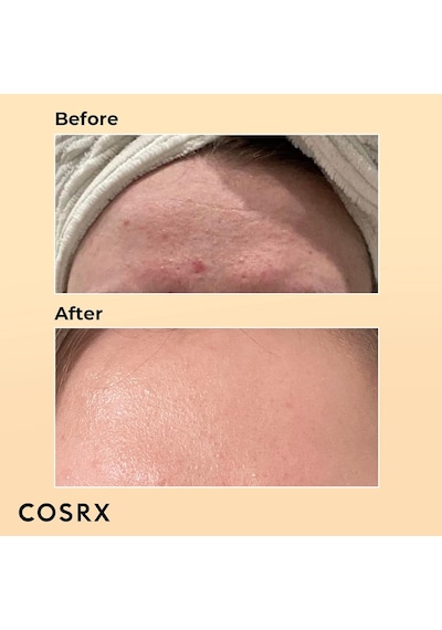 Cosrx Advanced Snail 96 Mucin Power Essence 100 ML