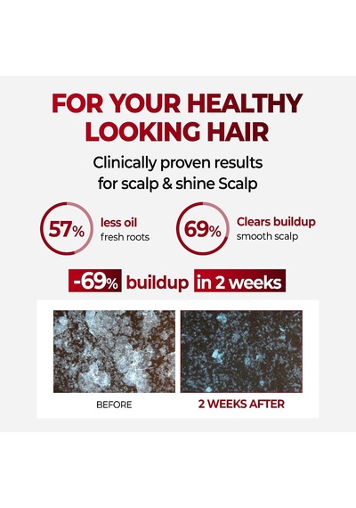 Kafein İçeren Dökülme Karşıtı Bakım Şampuanı Caffeine Scalp Shampoo 500ml Cherry Blossom