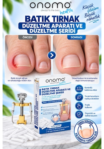 Onomo Health Batık Tırnak Düzeltici Batık Tırnak Çıkartıcı