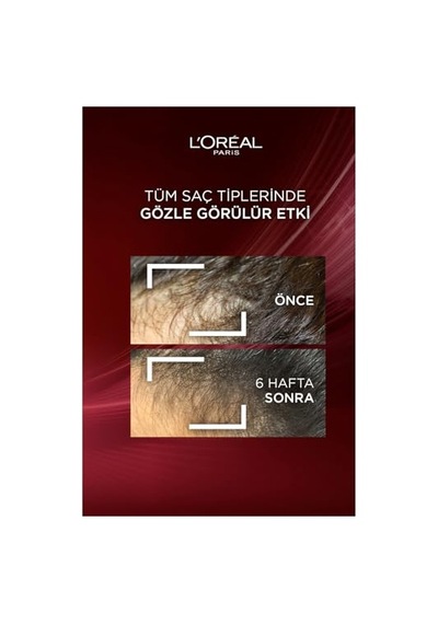L'oreal Paris Komple Direnç Dökülme Karşıtı Bakım Kremi 250ml