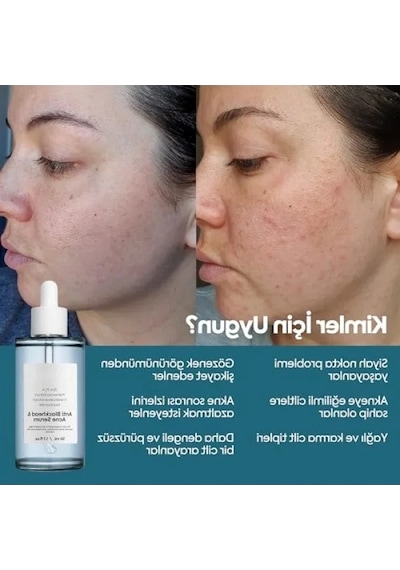Gözenek Sıkılaştırıcı Niacinamide Yüz Serumu, 50 Ml