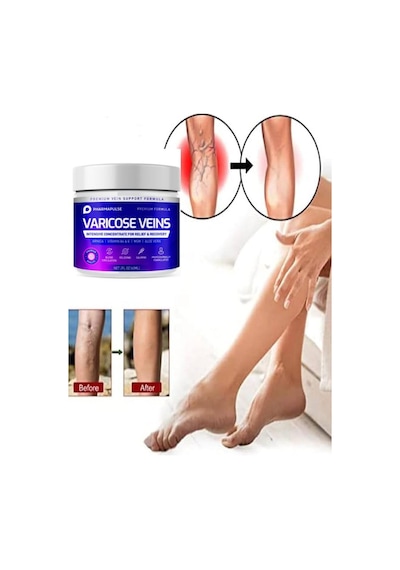 Maximum Strength Varicose Vein Var.is Bacak Bakım Masaj Kremi 100 Ml 2 Adet