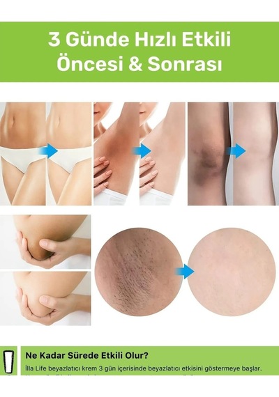 İlla Life Doğal Koltuk Altı & Bikini Bölgesi Beyazlatıcı Krem 50 ML