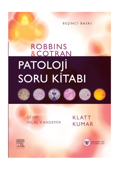 Robbins Patoloji Soru Kitabı Kapsamlı Gözden Geçirme