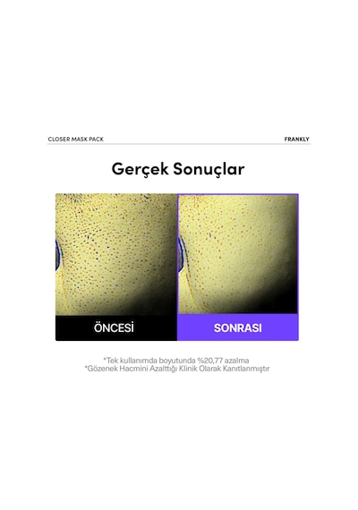 Frankly Pirinç Özü Peptit Ve Kolajen İçeren Gözenek Sıkılaştırıcı Kağıt Maske 22 ML