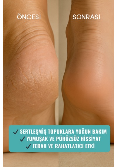Heél Rescue Çatlak Topuk Yoğun Bakım Balmı 100 Gr, Shea & Çay Ağacı, Doğal Ayak Kremi