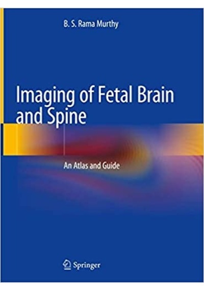 Imagıng of fetal Brain and Spine