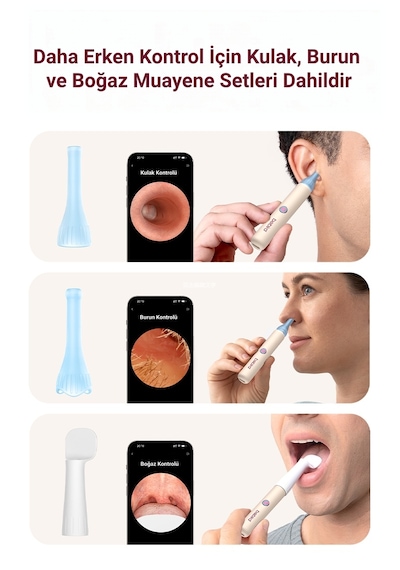 Bebird Earsight 3 Pro Hd Kameralı Akıllı Kulak Temizleme Cihazı