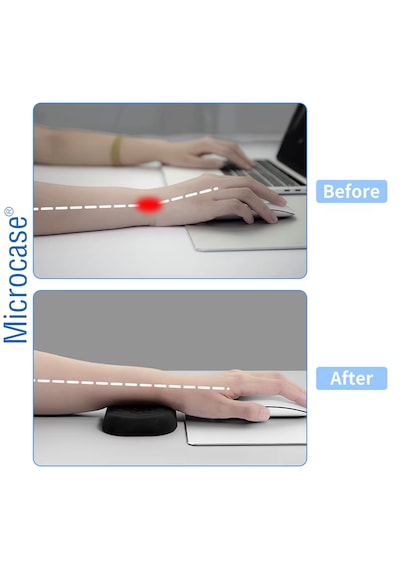 Microcase Ortopedik Klavye Bilek Destek Kaydırmaz Taban Ergonomik Klavye Önü Bilek Destek Pedi - Al5372 Siyah