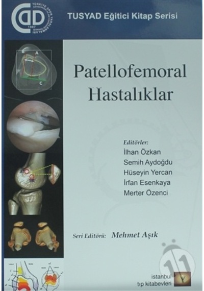 Patellofemoral Hastalıklar