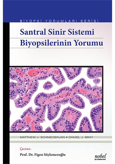 Santral Sinir Sistemi Biyopsilerinin Yorumu - Biyopsi Yorumları S N11.145