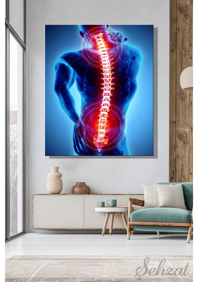 Duvar Tablosu Kare Kanvas Tekli Ofis Klinik Muayene Sağlık 3d Anatomi Servikal Ağrı Medikal