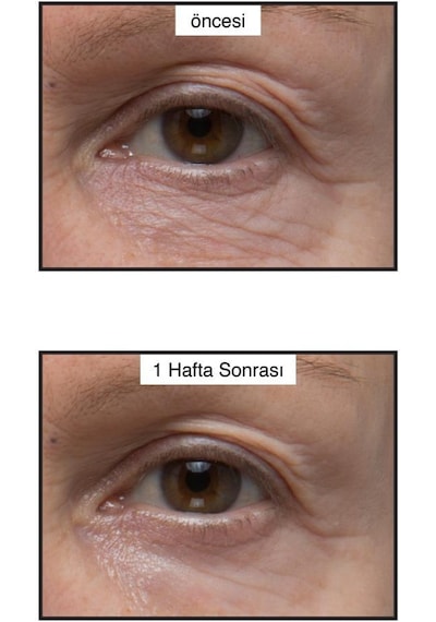 Murad Renewing Eye 15 ml Kırışık Göz Çevresi Kremi