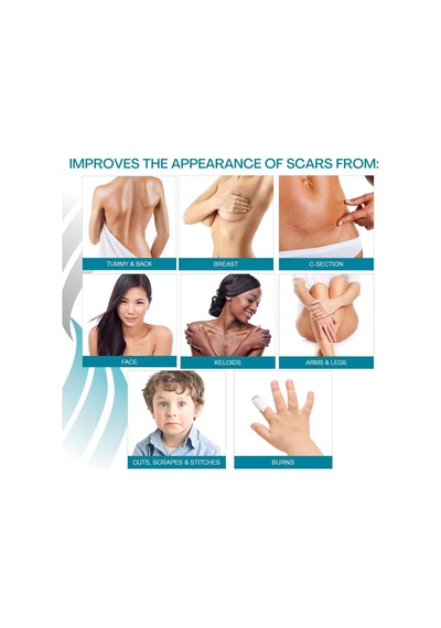 Newgel+ C-section Strips - Sezaryen Sonrası Silikon Yara İzi Bandı 5.1cm X 20cm - Şeffaf