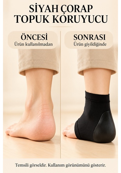 Mucit Home Siyah Topuğu Silikon Nemlendirici Topuk Çorabı 1 Çift Çatlak Nasır Nemlendirici Çorap