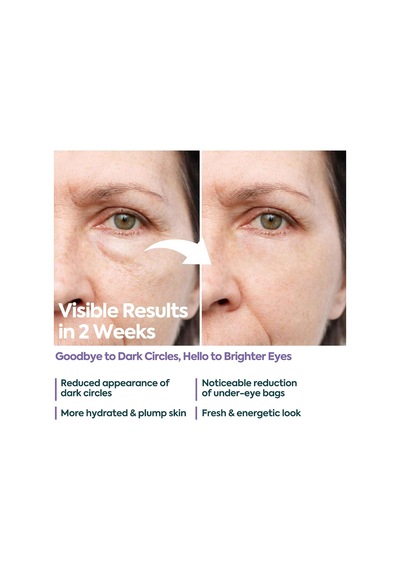 Clasy Care Göz Altı Kremi Morluk Ve Şişlik Karşıtı %5 Kafein +%2 Hyalüronik Asit Kırışıklık, Tor 11467527