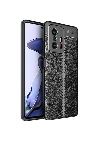 Adige Xiaomi Mi 11t Pro Kılıf Niss Deri Görünümlü Silikon