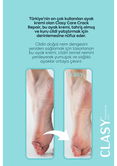 Ayak Ve Topuk Çatlak Kremi, Ayak Bakımı, Ayak Kokusu Ve Topuk 100ml
