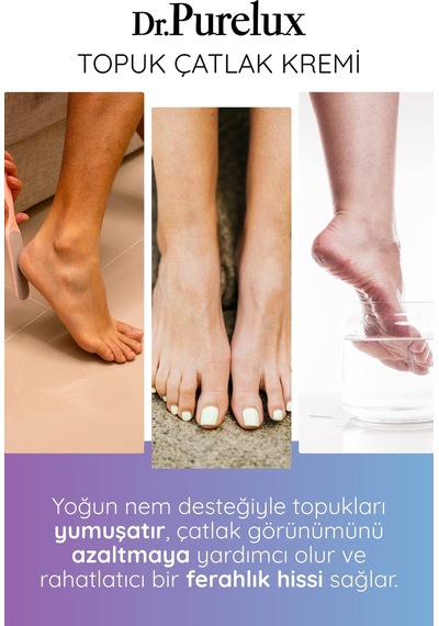 Topuk Çatlak Kremi Shea Yağı & Hyaluronik Asit İçerikli Yoğun Nemlendirici Bakım Kremi 100 Ml